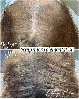 pigmentation